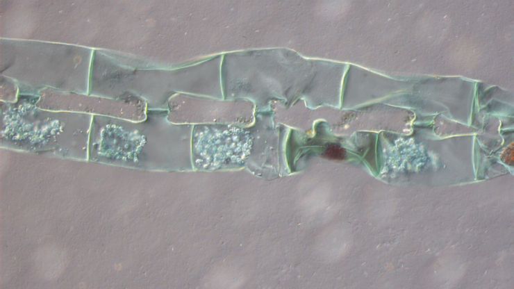 Spirogyra algae which has been imaged with an optical microscope using DIC. The algae appears to be undergoing scalariform conjugation, a form of sexual reproduction. Spirogyra algae (Conjugation), Transmitted Light Differential Interference Contrast.